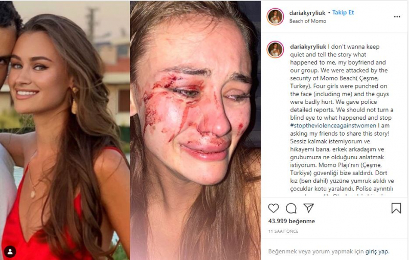 Дария Кирилюк, моделката, която беше бита в Измир Чешме, беше хваната от коронавирус!