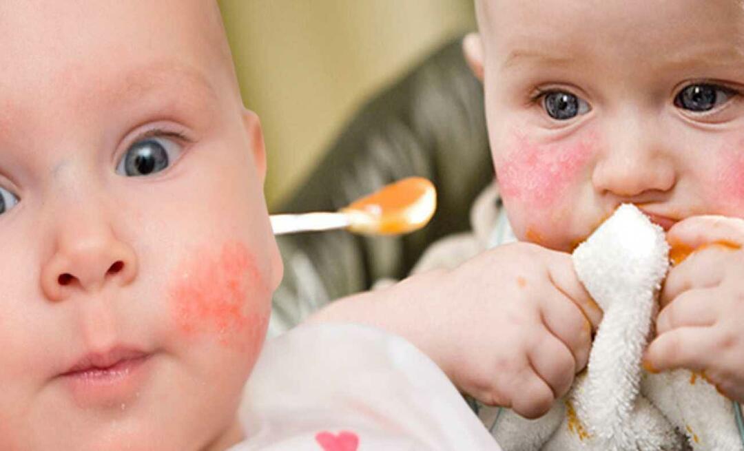 Какво трябва да яде бебе с алергии? Какви са алтернативните храни за алергични бебета?