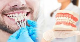 Защо се поставя циркониева фасета върху зъбите? Колко издръжливо е циркониевото покритие?