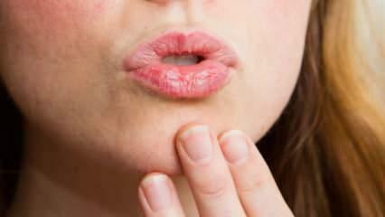 Как да се грижим за устните у дома? Лесна грижа за сухи устни в 4 стъпки
