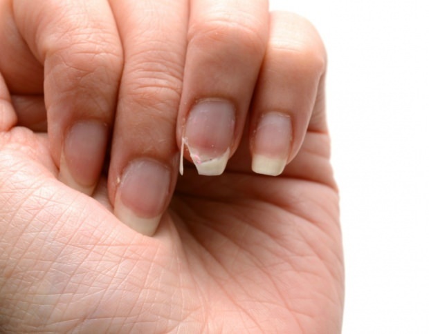 Как се прави грижата за ноктите? Бързи методи за удължаване на ноктите