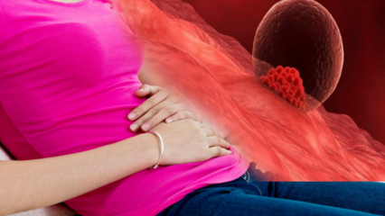 Какво представлява имплантационното кървене по време на бременност? Как да разграничим кървенето от менструално кървене