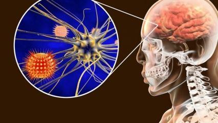 Какво представлява менингитът и какви са неговите симптоми? Има ли лечение за менингит?