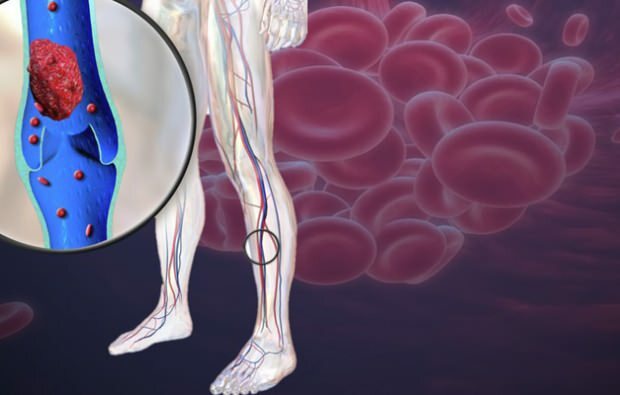 намаленото кръвообращение във вените на краката причинява болка